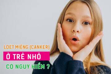 Loét canker (nhiệt miệng) ở trẻ nhỏ có nguy hiểm?