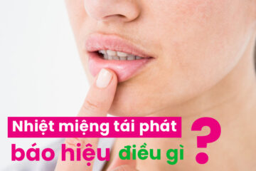 Nhiệt miệng tái phát báo hiệu điều gì?